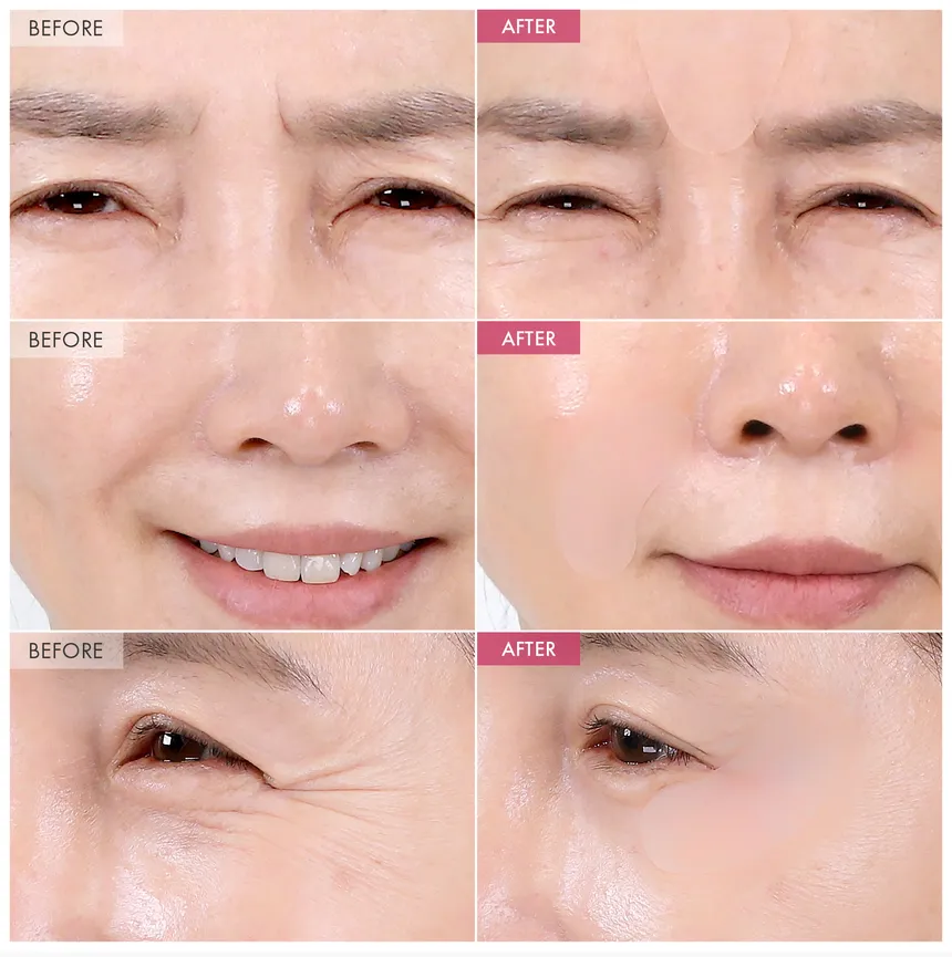 SOS Intensive Magic Clinic Anti-Wrinkle Patch