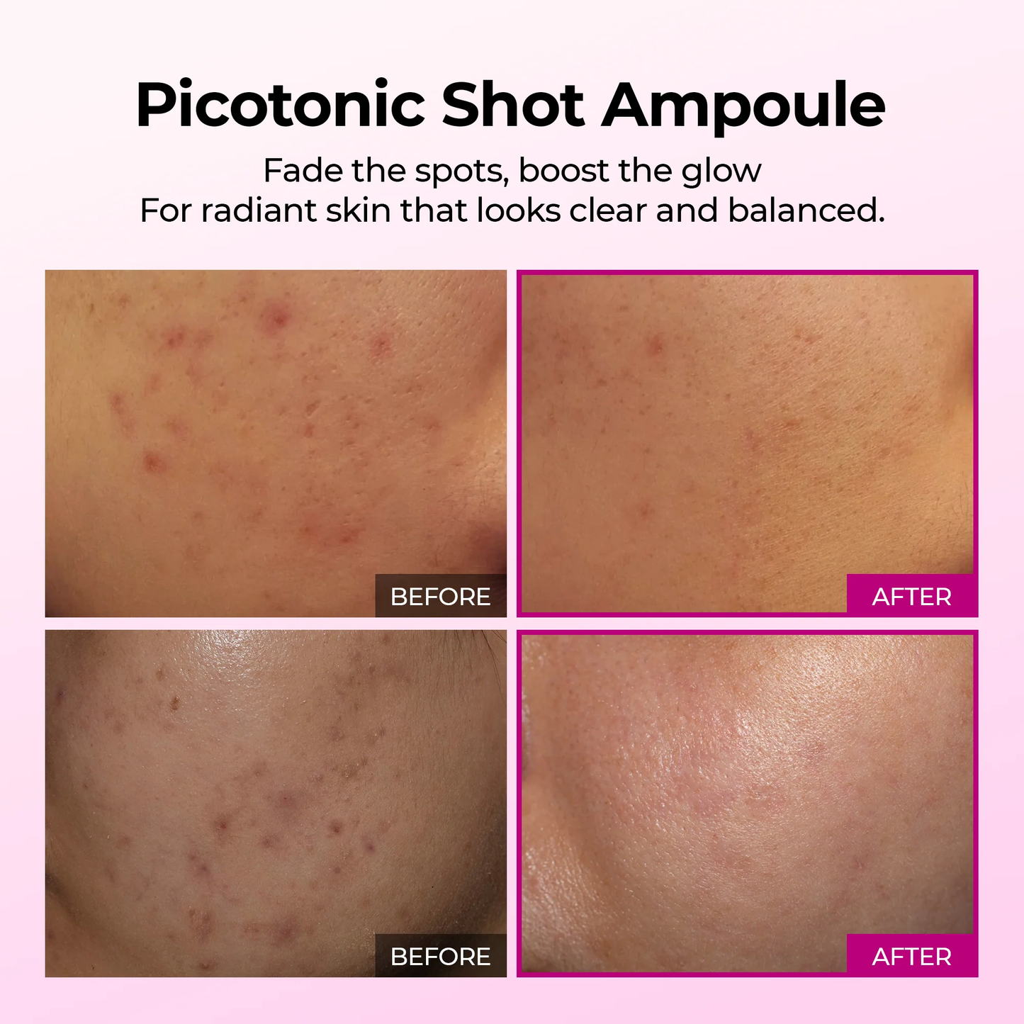 Picotonic Shot Pigmentation Serum